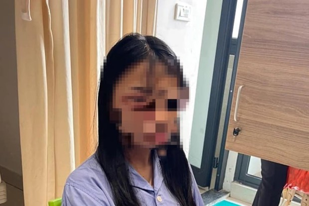 Công an giám định thương tích nữ sinh lớp 8 ở Hà Nội bị đánh hội đồng - Ảnh 1.