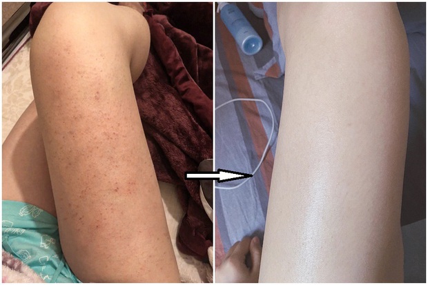 Cô nàng loại bỏ viêm nang lông, da sần sùi ngay tại nhà với combo sữa tắm + lotion body - Ảnh 2. Cô nàng loại bỏ viêm nang lông, da sần sùi ngay tại nhà với combo sữa tắm + lotion body - Ảnh 2.