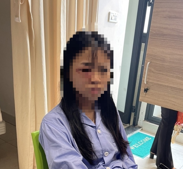 Nữ sinh bị đánh hội đồng ở Đông Anh vẫn hoảng loạn, đang điều trị tại bệnh viện - Ảnh 1. Nữ sinh bị đánh hội đồng ở Đông Anh vẫn hoảng loạn, đang điều trị tại bệnh viện - Ảnh 1.