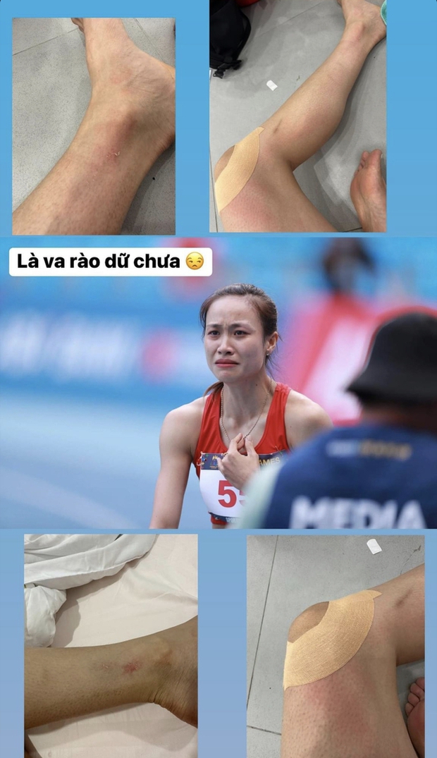 Ngắm chân trầy xước của Hotgirl 6 múi vô địch điền kinh SEA Games 32