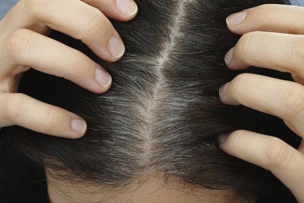 Thuốc nhuộm tóc có gây ung thư không? Nghiên cứu 35 năm khiến nhiều người sững sờ - Ảnh 2.