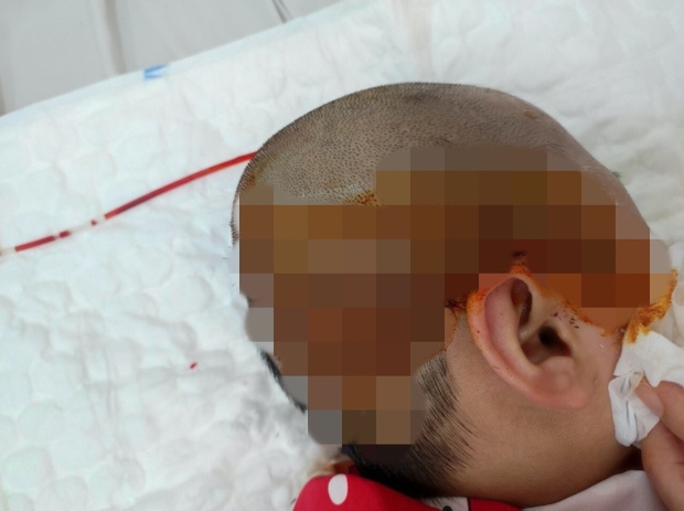 Bé gái 10 tuổi chiến thắng ung thư sau 4 lần mổ não, vượt qua nửa người bị liệt