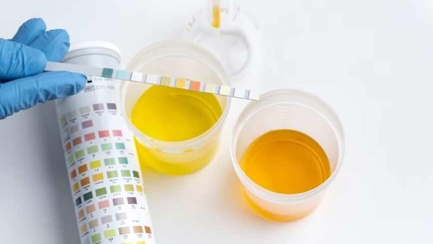 Những dấu hiệu trên chân bạn nên biết để phòng tránh bệnh thận sớm