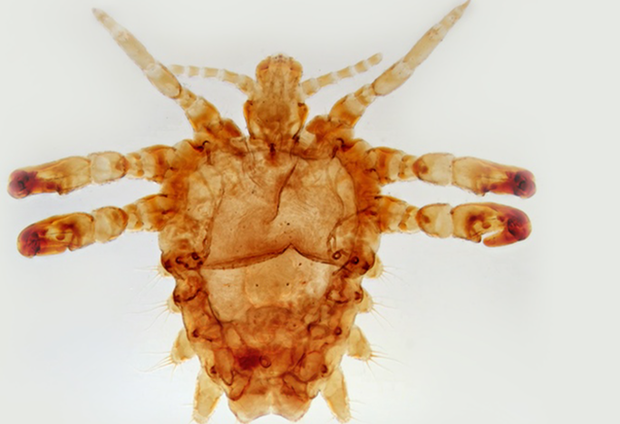 Hàng trăm con rận mu lũ lụt mi mắt bé gái 5 tuổi