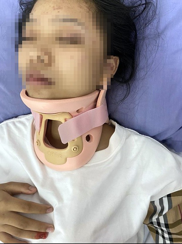 Nam thanh niên tấn công và tát đánh thiếu nữ 16 tuổi tại nhà: Gia đình sốc bàng hoàng!