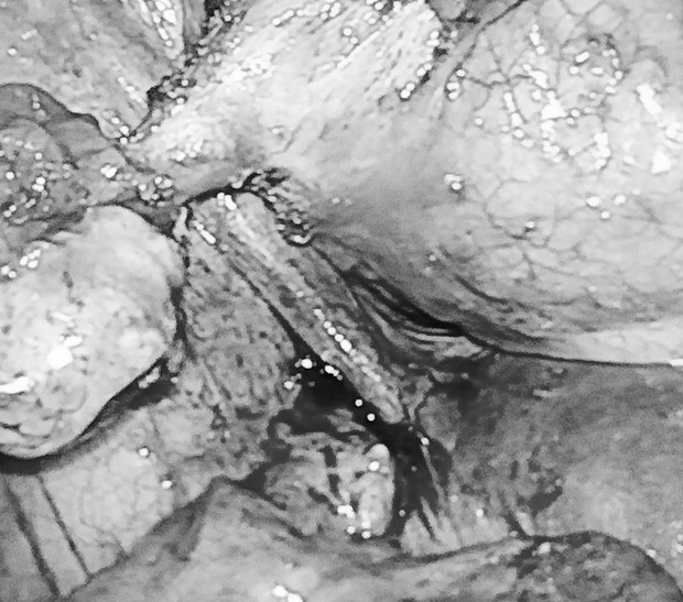 Phát hiện chóng mắt: Bệnh nhân nữ bị rối loạn hiếm gặp khi đi tiểu có thể sinh ra những sợi tóc