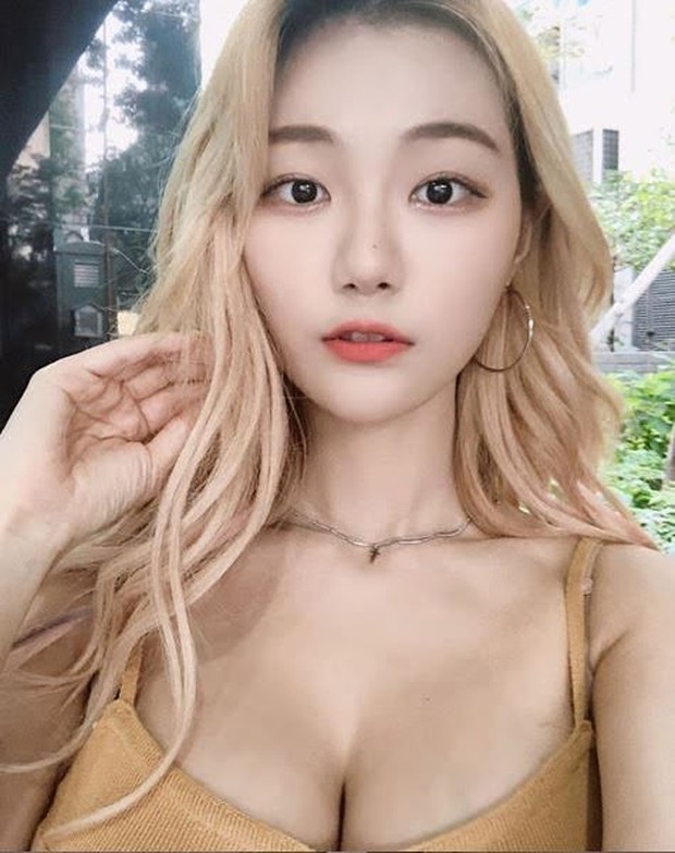 Streamer nổi tiếng gặp tai nạn đáng sợ, bí mật chấn động từ quá khứ