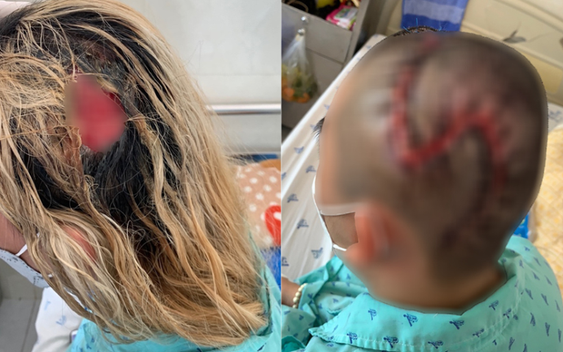 Bí quyết giảm thiểu tác hại khi tẩy tóc để hoàn thiện vẻ đẹp da đầu