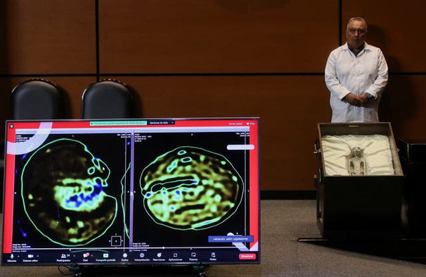 Mexico: Trưng bày 2 thi hài hoá thạch nghi người ngoài hành tinh, chuyên gia khẳng định DNA không tương thích với người Trái đất - Ảnh 4.