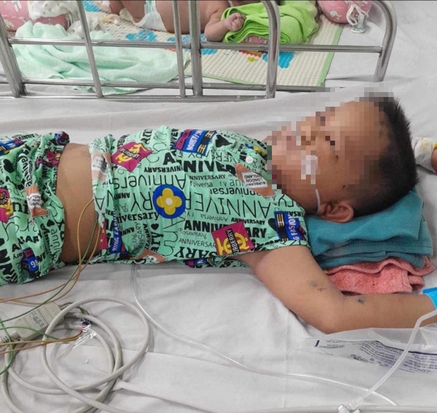 Kinh hoàng: Mẹ bị ong vò vẽ đốt, 3 con nhỏ hết hồn bị thương nặng