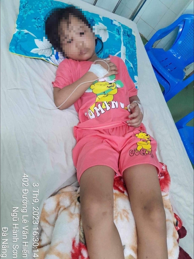 Kinh hoàng: Mẹ bị ong vò vẽ đốt, 3 con nhỏ hết hồn bị thương nặng