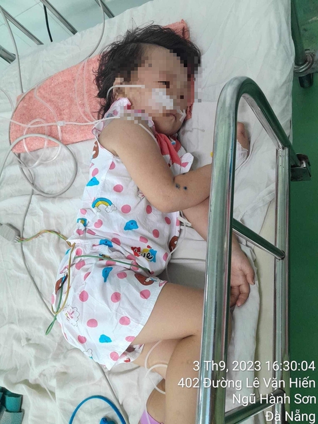 Kinh hoàng: Mẹ bị ong vò vẽ đốt, 3 con nhỏ hết hồn bị thương nặng