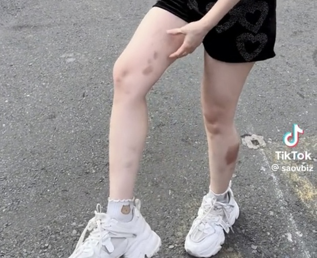 Quỳnh Nga và Lệ Quyên: Hồi sinh với danh hiệu và vết thương màu tím ở Đạp gió