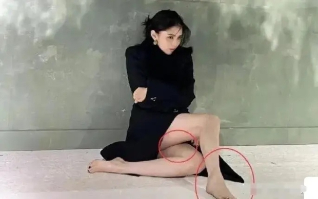 Truyền thông Hoa ngữ đặt nghi vấn Han So Hee bị bạo hành do xuất hiện nhiều vết bầm tím trên cơ thể - Ảnh 3.