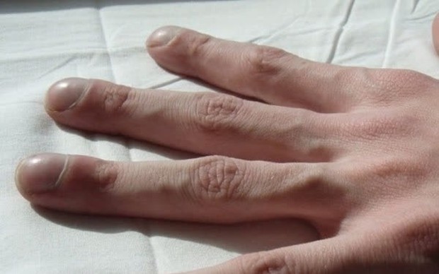 Bàn tay có thể nói lên tuổi thọ của một người, sống lâu ắt sẽ xuất hiện 6 điểm đặc biệt - Ảnh 2.