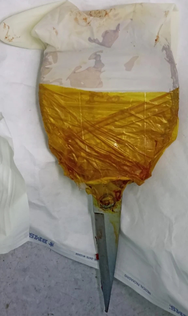 Người đàn ông mù 2 mắt tự lấy kéo đâm vào bụng và cổ - Ảnh 3.