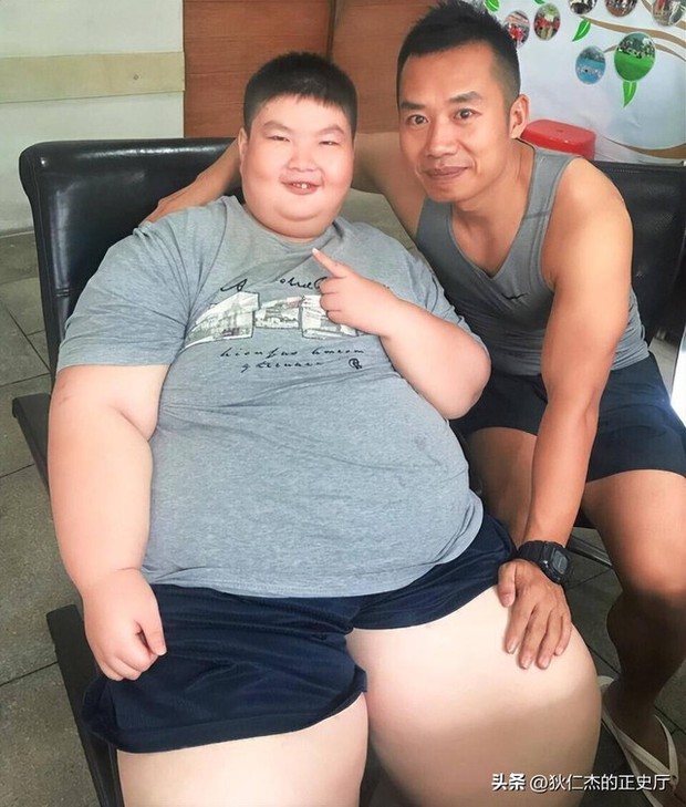 Cậu bé nặng nhất Trung Quốc 14 tuổi đã 150kg, có thể ăn 1 thùng mì gói 1 ngày có kết cục ra sao? - Ảnh 4.