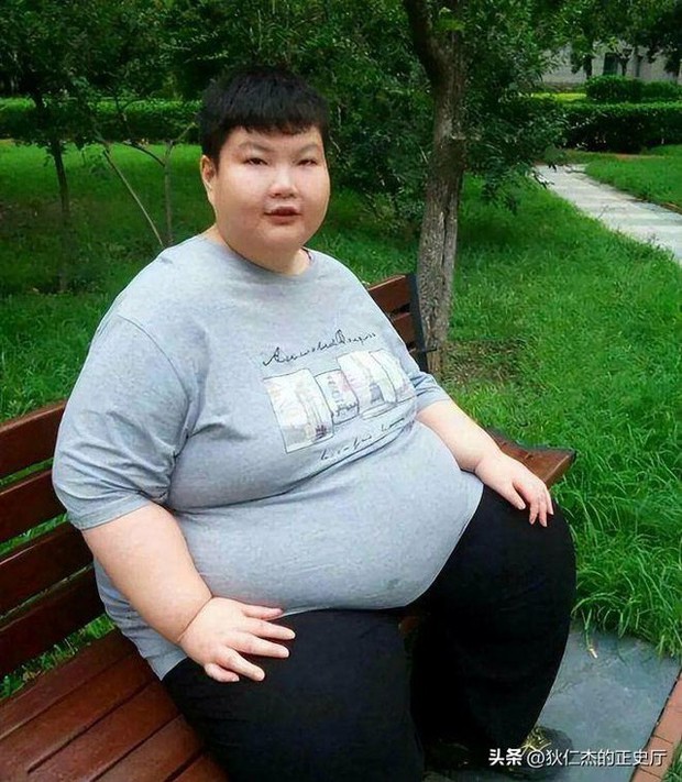 Cậu bé nặng nhất Trung Quốc 14 tuổi đã 150kg, có thể ăn 1 thùng mì gói 1 ngày có kết cục ra sao? - Ảnh 3.