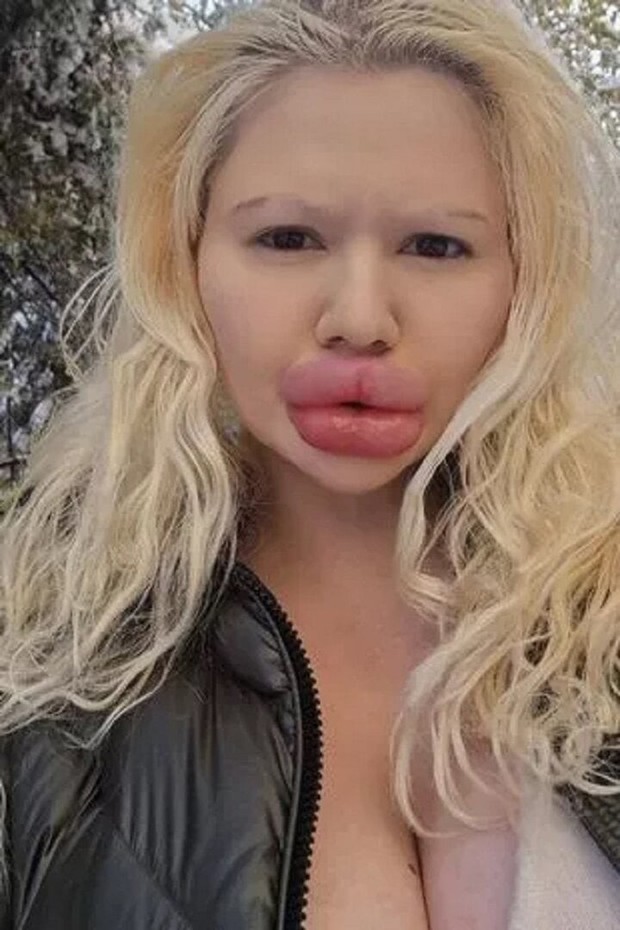 Cô gái có đôi môi lớn nhất thế giới muốn bán đấu giá những nụ hôn - Ảnh 3.