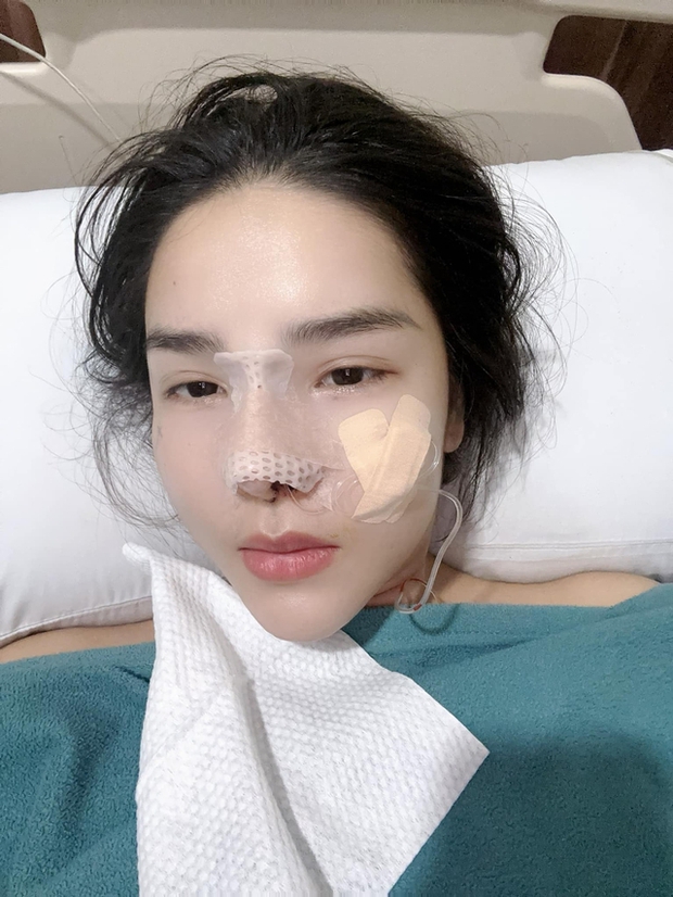 Bị dân tình chê vì làm mũi không đẹp, Kỳ Hân - vợ Mạc Hồng Quân - Ảnh 2