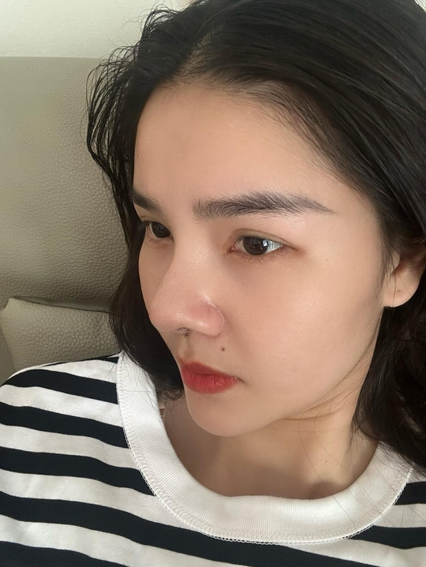 Bị dân tình chê vì làm mũi không đẹp, Kỳ Hân - vợ Mạc Hồng Quân - Ảnh 1