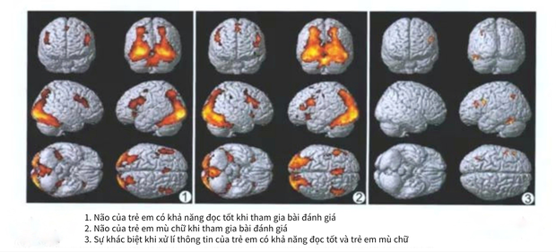 Bộ não của trẻ chăm chỉ đọc với không đọc có sự khác biệt cực lớn: Không lưu ý, 10 năm sau cha mẹ mới ngỡ ngàng - Ảnh 1.