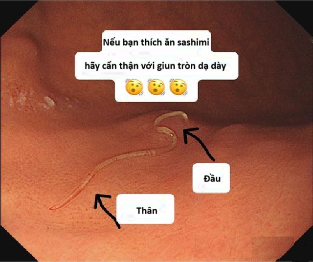 Người đàn ông đột n…