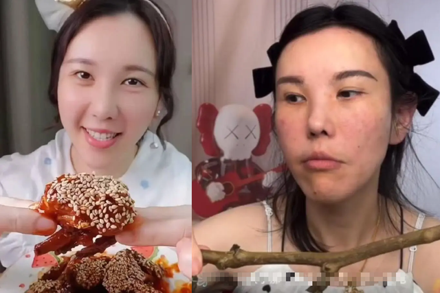 Mặt cô gái biến dạng sau 2 năm làm mukbang, đây là những cái giá cực đắt về sức khỏe khi chạy theo trào lưu này- Ảnh 3.