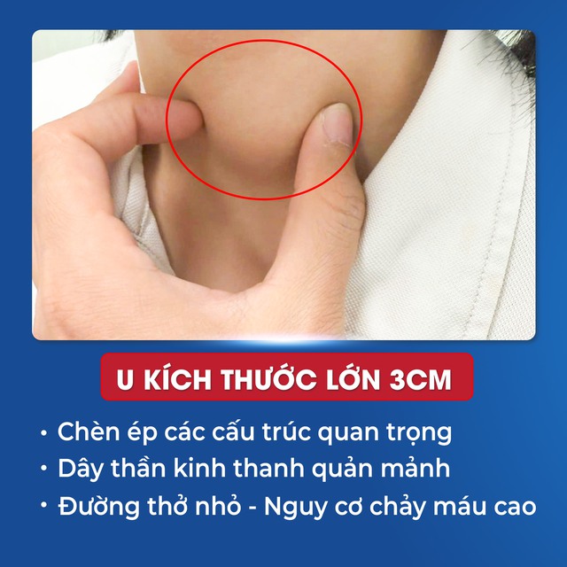Bé trai 13 tuổi mắc ung thư tuyến giáp, phát triển nhanh chỉ trong vài tuần- Ảnh 1.