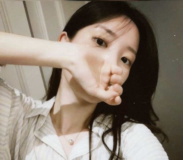 Xuất hiện 4 thứ màu đen này trên mặt thì phải khám thận sớm, trường hợp xấu nhất là... ung thư- Ảnh 1. Xuất hiện 4 thứ màu đen này trên mặt thì phải khám thận sớm, trường hợp xấu nhất là... ung thư- Ảnh 1.