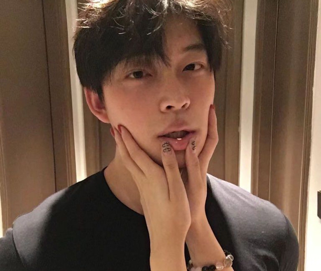 Xuất hiện 4 thứ màu đen này trên mặt thì phải khám thận sớm, trường hợp xấu nhất là... ung thư- Ảnh 2. Xuất hiện 4 thứ màu đen này trên mặt thì phải khám thận sớm, trường hợp xấu nhất là... ung thư- Ảnh 2.