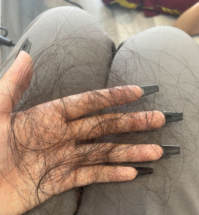 Chải đầu mà thấy 3 bất thường này phải cảnh giác với ung thư: Tiếc là ít người để tâm!- Ảnh 1. Chải đầu mà thấy 3 bất thường này phải cảnh giác với ung thư: Tiếc là ít người để tâm!- Ảnh 1.