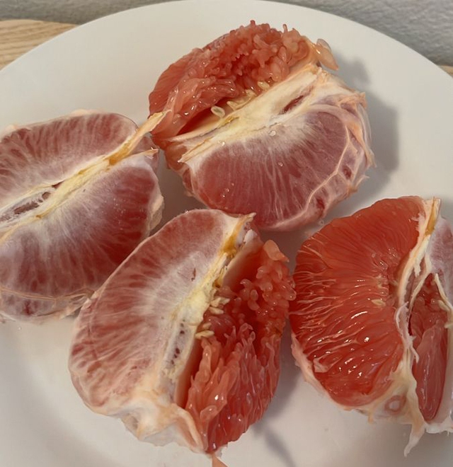 Chợ Việt có 5 trái cây quen thuộc là "máy lọc rác" trong tử cung, bồi bổ cho nữ giới nhưng không phải ai cũng biết- Ảnh 3. Chợ Việt có 5 trái cây quen thuộc là "máy lọc rác" trong tử cung, bồi bổ cho nữ giới nhưng không phải ai cũng biết- Ảnh 3.