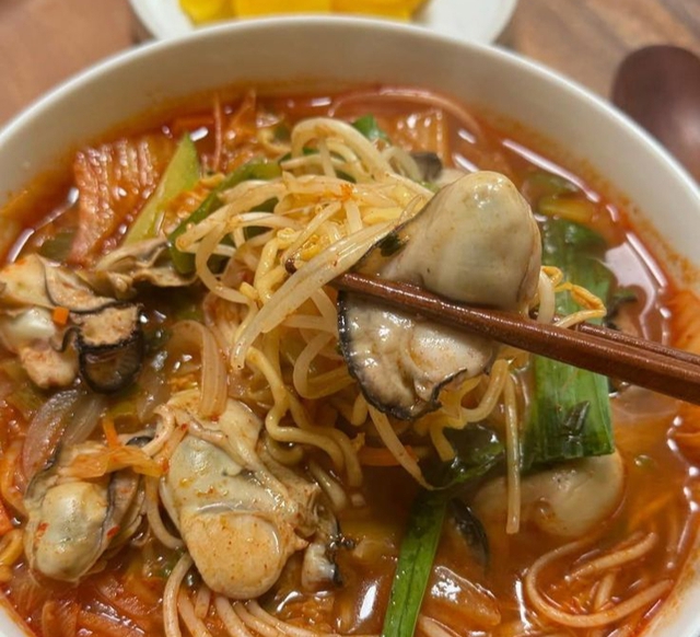 Cô gái sụt 15kg, dạ dày bị liệt vì món mì hot trend bao năm giới trẻ Việt vẫn "mê như điếu đổ"- Ảnh 2. Cô gái sụt 15kg, dạ dày bị liệt vì món mì hot trend bao năm giới trẻ Việt vẫn "mê như điếu đổ"- Ảnh 2.