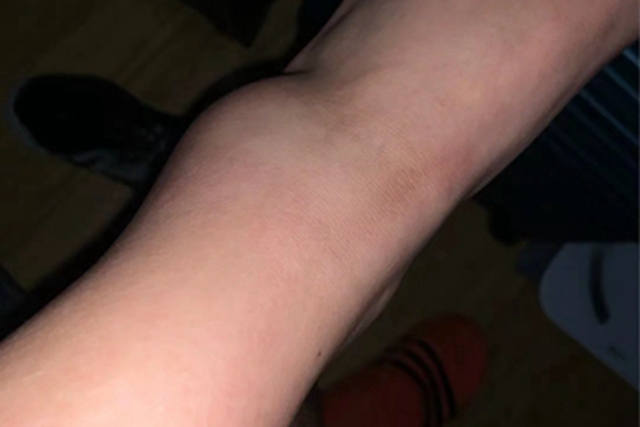 “3 to, 2 trắng” thường xuất hiện ở nam giới có tuổi thọ ngắn, không có cái nào thì quả là may mắn!- Ảnh 2. “3 to, 2 trắng” thường xuất hiện ở nam giới có tuổi thọ ngắn, không có cái nào thì quả là may mắn!- Ảnh 2.