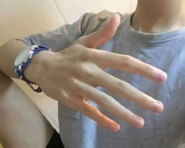 “3 to, 2 trắng” thường xuất hiện ở nam giới có tuổi thọ ngắn, không có cái nào thì quả là may mắn!- Ảnh 3. “3 to, 2 trắng” thường xuất hiện ở nam giới có tuổi thọ ngắn, không có cái nào thì quả là may mắn!- Ảnh 3.