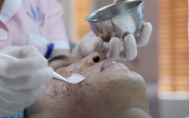 Không chuẩn bị đủ những điều này, bác sĩ khuyên đừng phẫu thuật thẩm mỹ- Ảnh 3.