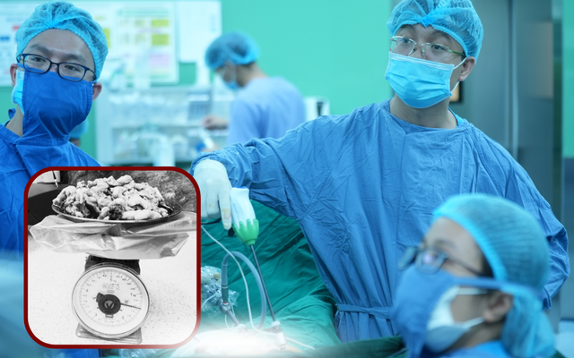 Người phụ nữ hơn 1 thập kỷ “sống chung” với u xơ tử cung nặng gần 1.5kg- Ảnh 1.