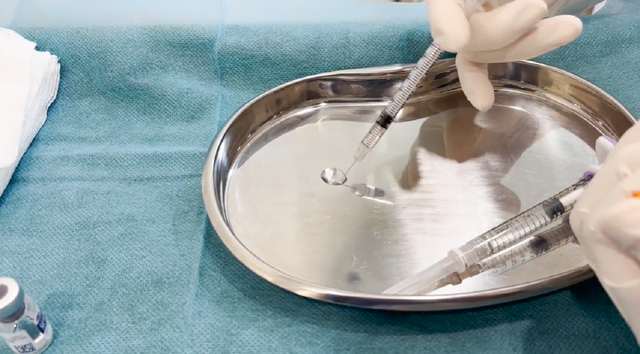 Filler giá rẻ bán tràn lan trên mạng, "mua dễ hơn rau": Chuyên gia chỉ cách nhận biết filler thật giả, kém chất lượng- Ảnh 4.