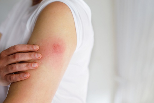 7 việc nữ giới nhất định KHÔNG ĐƯỢC LÀM ngay sau khi vừa tiêm vắc xin HPV- Ảnh 1.
