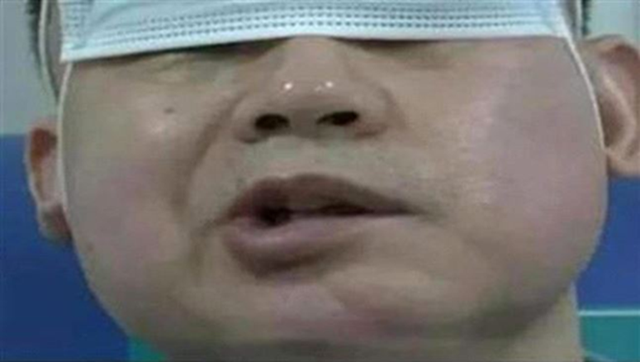 Bật điều hòa ngủ cho mát, người đàn ông bị liệt mặt, bác sĩ cảnh bảo thói quen yêu thích của người trẻ- Ảnh 1.