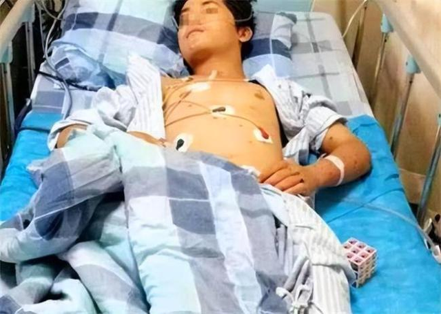 Chàng trai 17 tuổi suy thận giai đoạn cuối vì ăn quá nhiều 2 món nhưng vì "quá ngon" nên không ai từ chối- Ảnh 1.