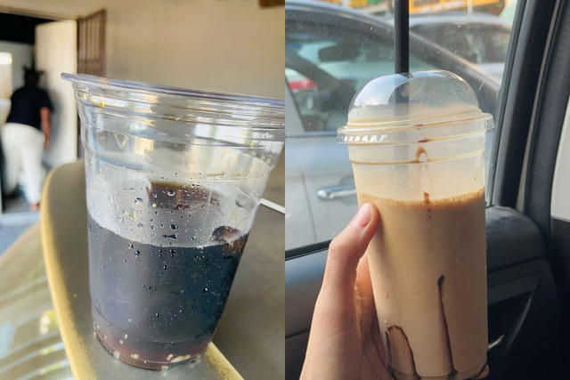 Người đàn ông rất chăm uống nước nhưng vẫn suy thận cấp, bác sĩ tức giận: "Nước này uống nhiều như thuốc độc"- Ảnh 2.