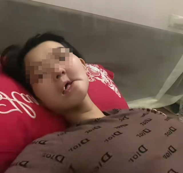 Hình ảnh cô gái mắc ung thư xương hàm, bữa ăn hàng ngày là "cháo xay loãng ăn bằng xi lanh" gây xót xa: Dấu hiệu phát hiện bệnh sớm trước khi quá muộn- Ảnh 1.