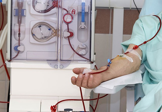 “Suy thận” trở thành từ khóa nóng sau trường hợp nữ diễn viên Ngân Hòa: Căn bệnh đang trẻ hóa đáng báo động- Ảnh 3.