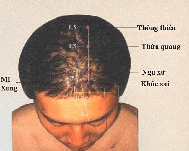 Trên đầu mỗi người có 1 “nút” làm chậm lão hóa, chạm vào nó 1 phút mỗi ngày để mắt sáng dù trăm tuổi- Ảnh 2.