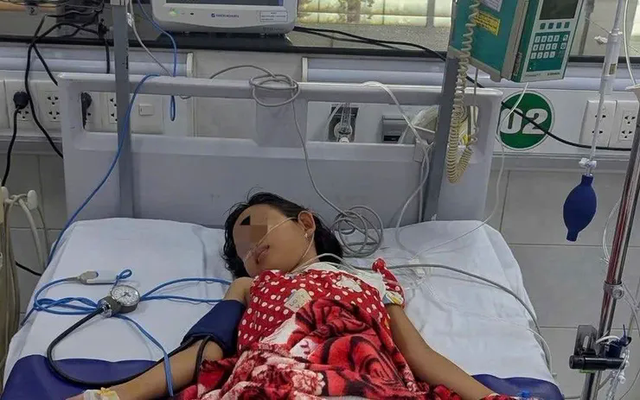 Sốt xuất huyết ở trẻ: Nhập viện muộn, sốc nặng, phải thở máy- Ảnh 1.
