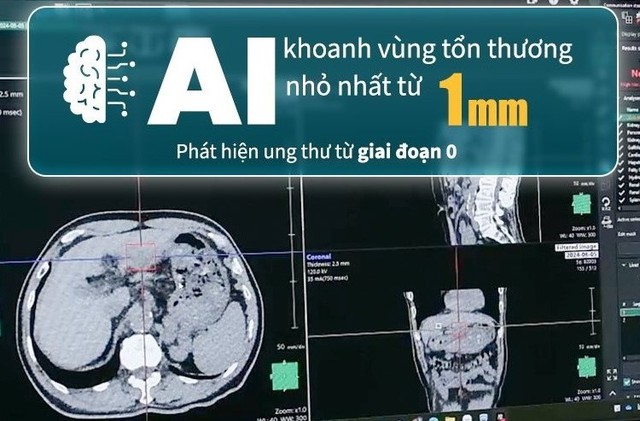 Người Nhật “thảnh thơi” với ung thư, vì sao vậy?- Ảnh 4.