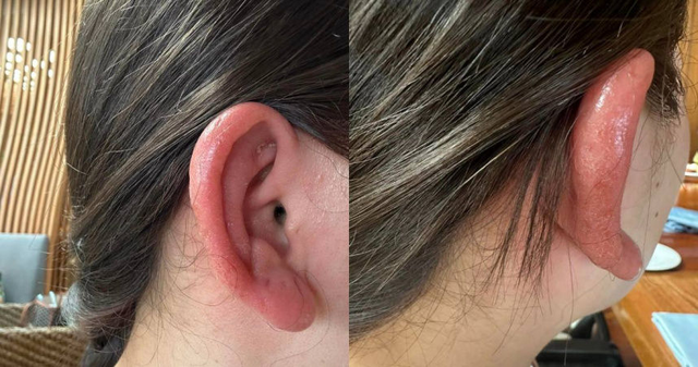 Loại khuyên tai bán chạy trên các sàn thương mại điện tử này tiềm ẩn chất độc, nên bỏ ngay kẻo hối không kịp- Ảnh 1.