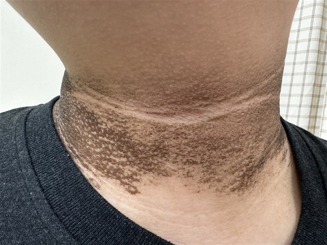 Nếu trong người có ung thư, 5 bộ phận này sẽ chuyển sang màu đen, tiếc rằng ít ai để ý!- Ảnh 1.